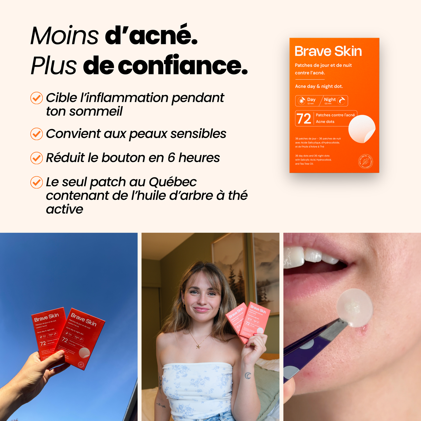 Patches de jour et de nuit contre l'acné