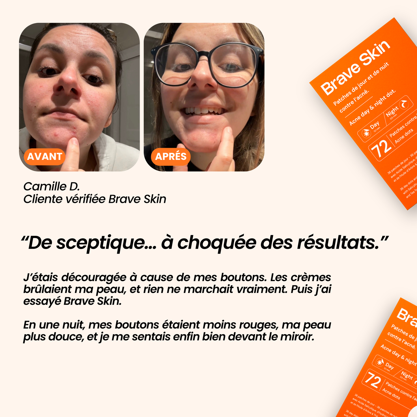 Patches de jour et de nuit contre l'acné