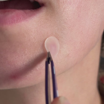 Patches de jour et de nuit contre l'acné